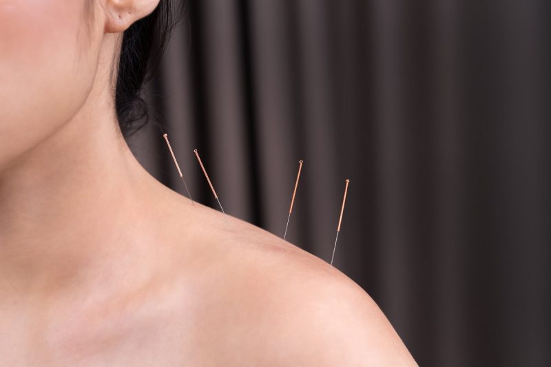 Acupuncture Harmonizing Chinese Medicine Clinic