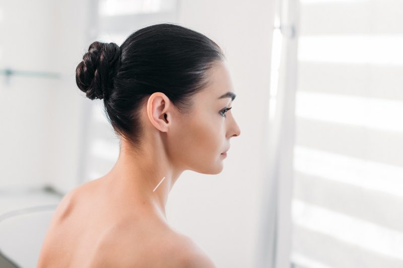 Acupuncture, Acupuncture Therapy