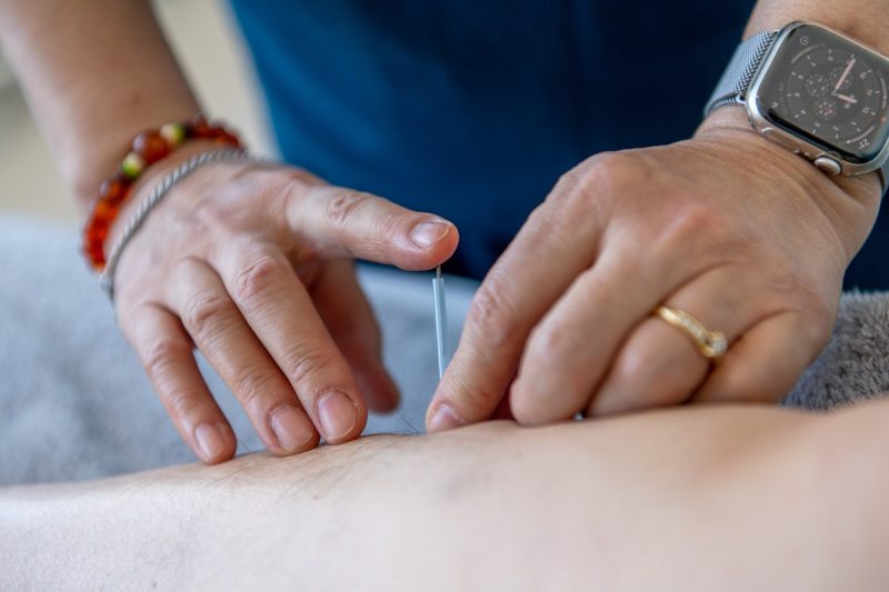 Acupuncture; Acupuncture for Hay Fever; Harmonizing Chinese Medicine Clinic